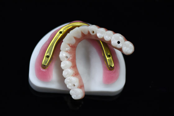 Customizable Dental Zirconia Bridge Over Milled Implant Bar High Accuracy