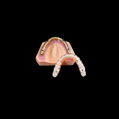 Customizable Dental Zirconia Bridge Over Milled Implant Bar High Accuracy