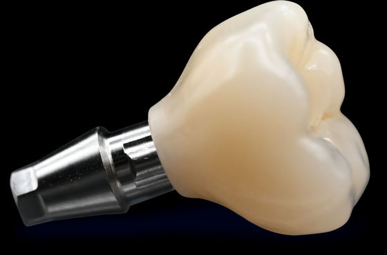 Buy CAD / CAM Implant Crown Bridge High Esthetics Zirconia Crown online manufacture