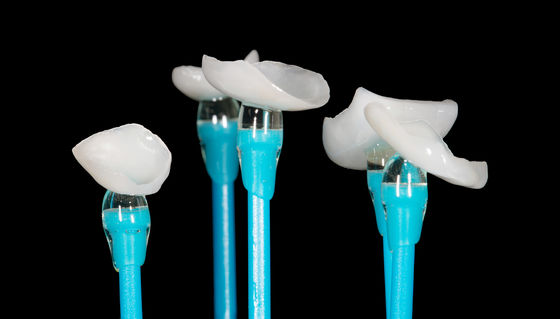 Buy EMAX Pressed Onlay Veneer High Accuracy Dental Veneer Excellent Fit online manufacture