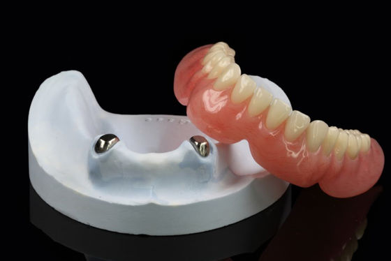 Buy Telescope Removable Dentures Precision Attachment Overdenture Arylic online manufacture