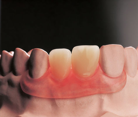Buy Flexible Flipper Removable Dentures Clinical Removable Partial Prosthodontics online manufacture