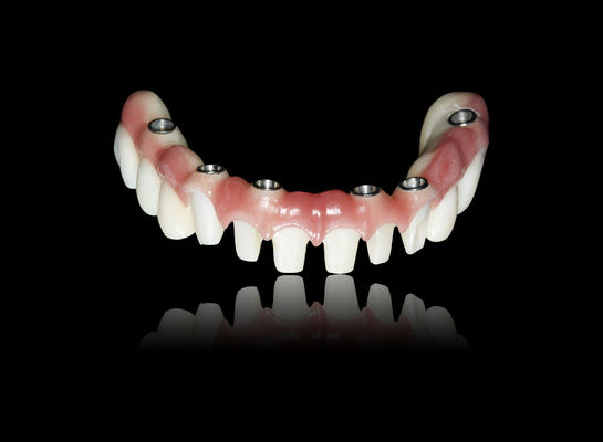 Buy ALL On  X Implant Zirconia Bridge Implant Crown Bridge Natural Appearance online manufacture