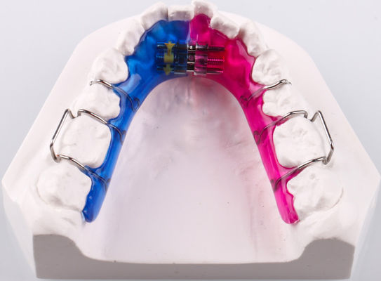 Buy Removable Bidirectional Teeth Palate Expander Orthodontics Appliance online manufacture