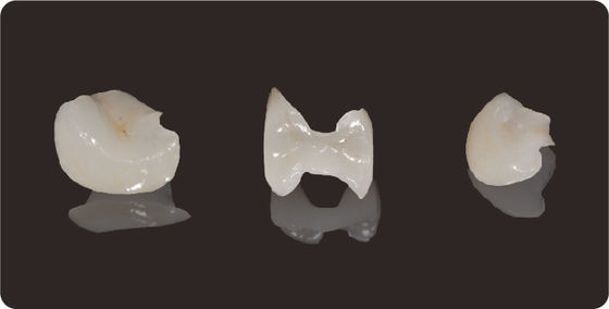Buy Accuracy Dental Inlays And Onlays Lithium Disilicate Milling Onlay Veneer online manufacture