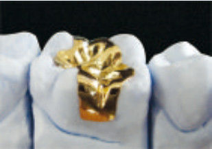 Buy Fit Excellent Dental Gold Onlay CE And FDA Gold Inlays And Onlays online manufacture