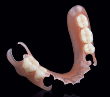 Buy Valplast Flexible Partial Removable Dentures Precision Attachment In Prosthodontics online manufacture