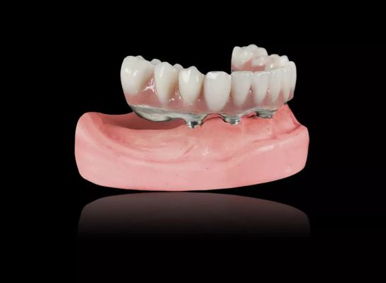 Buy Implant Titanium Bar Removable Dentures Titanium Alloy Implant Bar Overdenture online manufacture