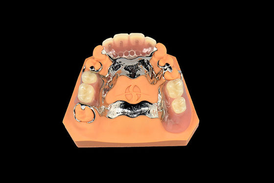 Buy Dental Implants Removable Dentures Vitallium Metal Partial Denture online manufacture