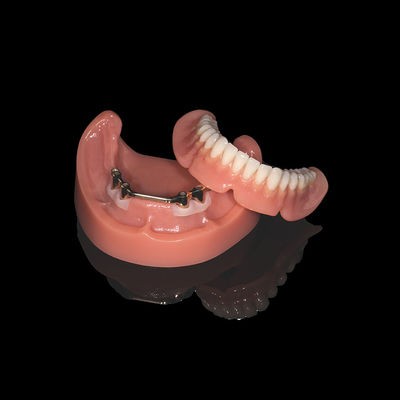 Buy Pink Titanium Bar Removable Dentures With Acrylic Denture Finish online manufacture