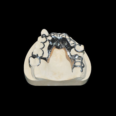 Buy High Accuracy Vitallium Framework Removable Tooth Denture Class 2 online manufacture