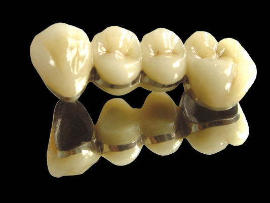 Buy Precious Metal Bridge Implant Crown Bridge Wear Resistant Customized online manufacture