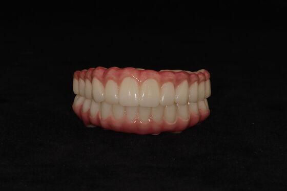 Buy Customize Hybrid Dental Implants Hybrid Denture With Titanium Bar online manufacture