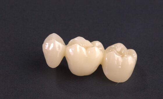 Buy Customized Dental Temporary Crown PMMA Temporary Bridge And Crown online manufacture