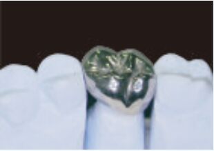 Buy Full Metal Crown And Bridge High Accuracy Silver Temporary Crown online manufacture