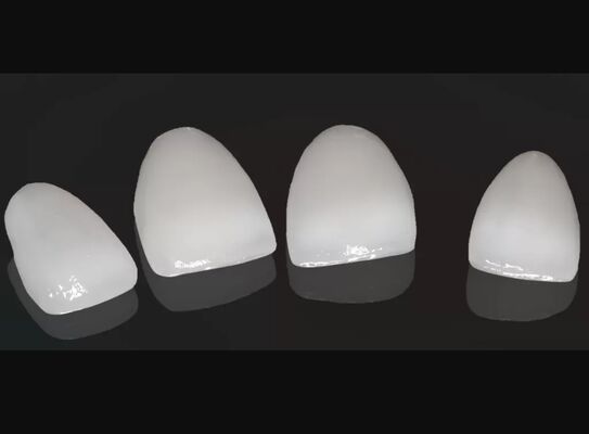 Buy High Esthetics Composite Crown Onlay Veneer Customizable Size online manufacture