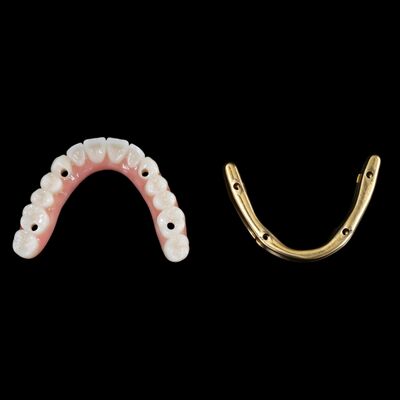 Buy Customize Hybrid Dental Implants Hybrid Denture With Titanium Bar online manufacture