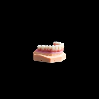 Buy Ti Base Crown Implant Titanium Crown / Bridge Coping With Composite online manufacture