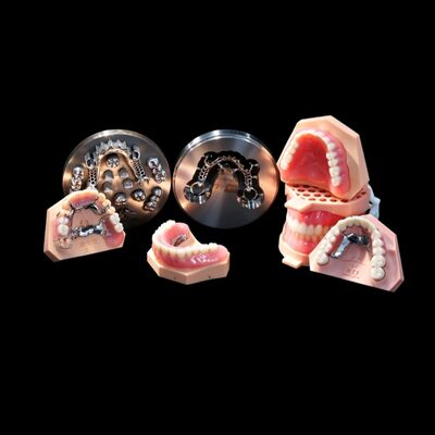 Buy Titanium Metal Framework Denture Removable False Teeth Custom online manufacture