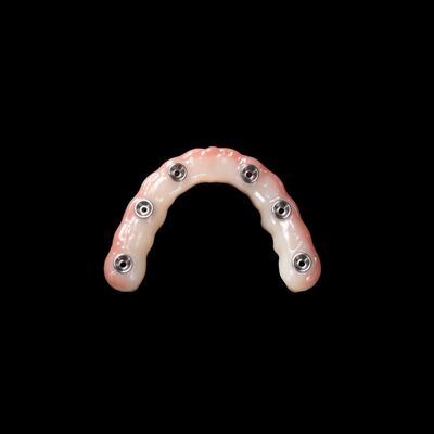 Buy Implanting Immediate Load Dentures Light Pink Removable Artificial Teeth online manufacture