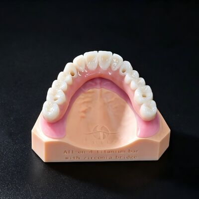 Buy ALL On  X Implant Zirconia Bridge Implant Crown Bridge Natural Appearance online manufacture