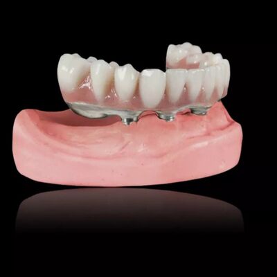 Buy Implant Titanium Bar Removable Dentures Titanium Alloy Implant Bar Overdenture online manufacture