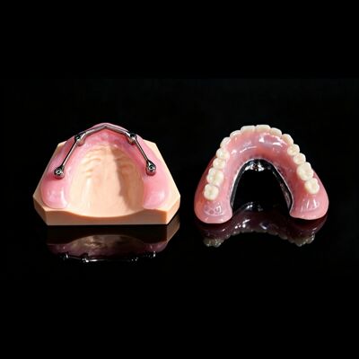 Buy All On X Implant Titanium Bar With Removable Denture online manufacture