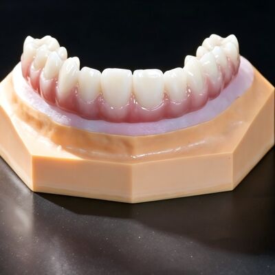 Buy FDA Titanium Bridge Dental Implant Titanium Framework With Crown online manufacture