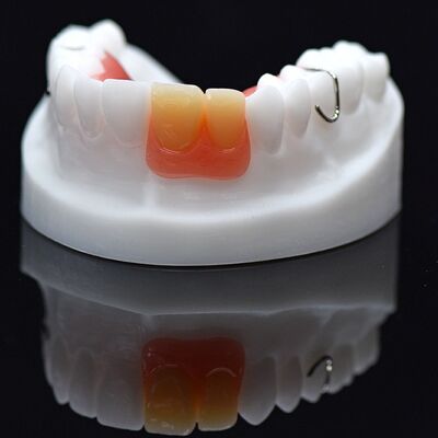 Buy Acrylic Flipper Removable Overdenture Customized Removable Acrylic Denture online manufacture