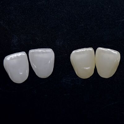 Buy Highly Aesthetic Zirconia Veneer Long Lasting Zirconia Emax Veneers online manufacture