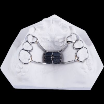 Buy Fixed Bidirectional Dental Palate Expander Dental Palate Spreader online manufacture