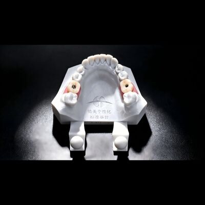 Buy Non Precious PFM Crown Implant Porcelain Fused To Metal Crown online manufacture