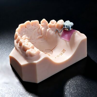 Buy Traction Appliance for Adjacent Teeth Prior to Implant Placement online manufacture