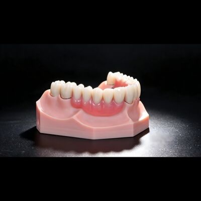 Buy Metal Framework Precision Attachment Overdenture Removable Tooth Denture online manufacture