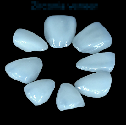 Buy EMAX Pressed Onlay Veneer High Accuracy Dental Veneer Excellent Fit online manufacture