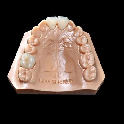 Buy Lava Crown And Bridge High Accuracy online manufacture