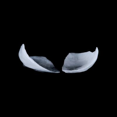 Buy Customizable Emax Press Crown Fast And High Esthetics Dental Venner online manufacture