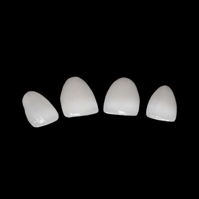 Buy CAD/CAM Porcelain Fused To Zirconia Bridge For Natural Looking Restoration online manufacture