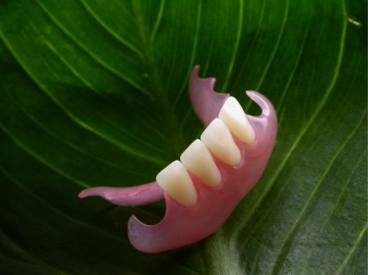 Duraflex Flexible Partial Detachable Esthetic Partial Denture