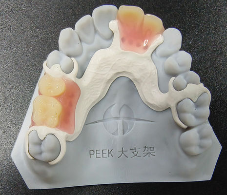 Customizable Peek Removable Denture Partial Framework Wear Resistance
