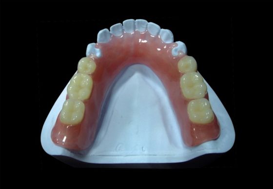 Pink Removable Partial Acrylic Denture Temporary Acrylic Partial Denture