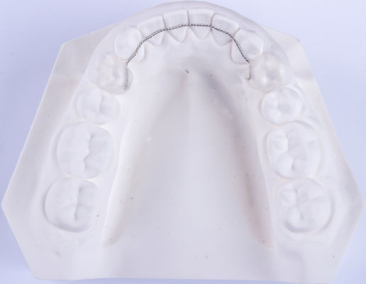 Non Removable Lingual Wire Retainer Orthodontics Retainers To Straighten Teeth