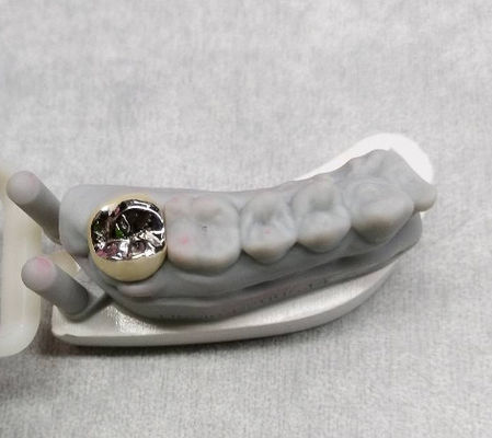 Semi Precious Alloy Metal Crown And Bridge Tooth Temporary Crown