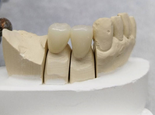 Customized Dental Temporary Crown PMMA Temporary Bridge And Crown
