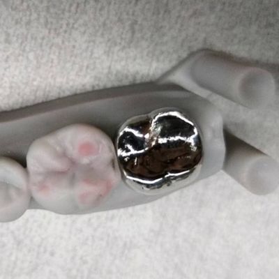 Full Metal Crown And Bridge High Accuracy Silver Temporary Crown