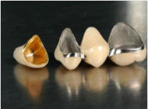 Noble Precious Alloy Crown And Bridge Yellow Provisional Crown