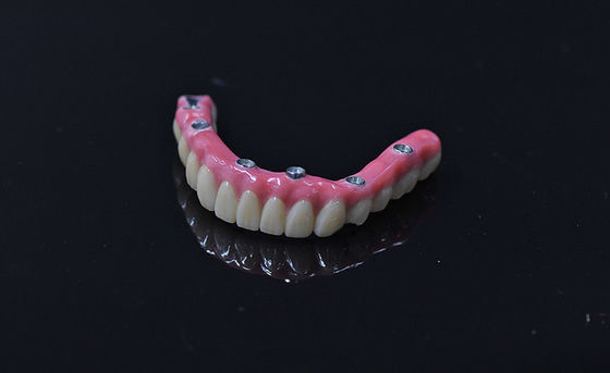 Implanting Immediate Load Dentures Light Pink Removable Artificial Teeth