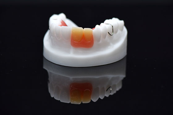 Acrylic Flipper Removable Overdenture Customized Removable Acrylic Denture
