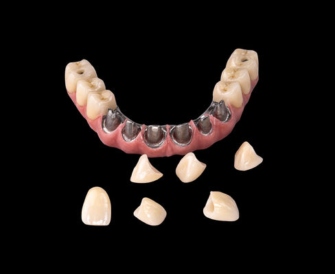 ALL On  X Implant Titanium Bridge Dental Only Framework Professional