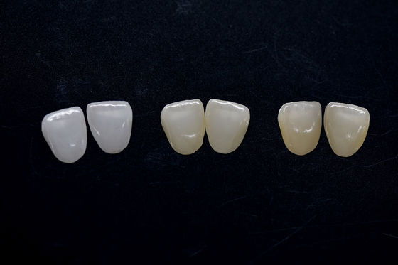 Highly Aesthetic Zirconia Veneer Long Lasting Zirconia Emax Veneers